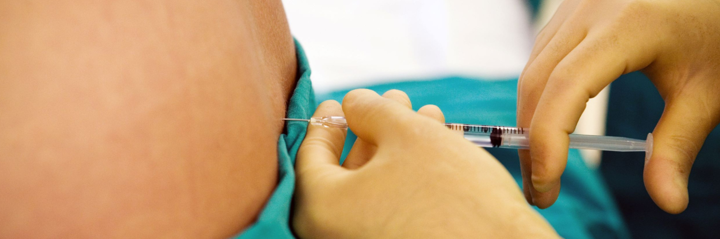 Tout comprendre sur la péridurale pour bien poser son choix